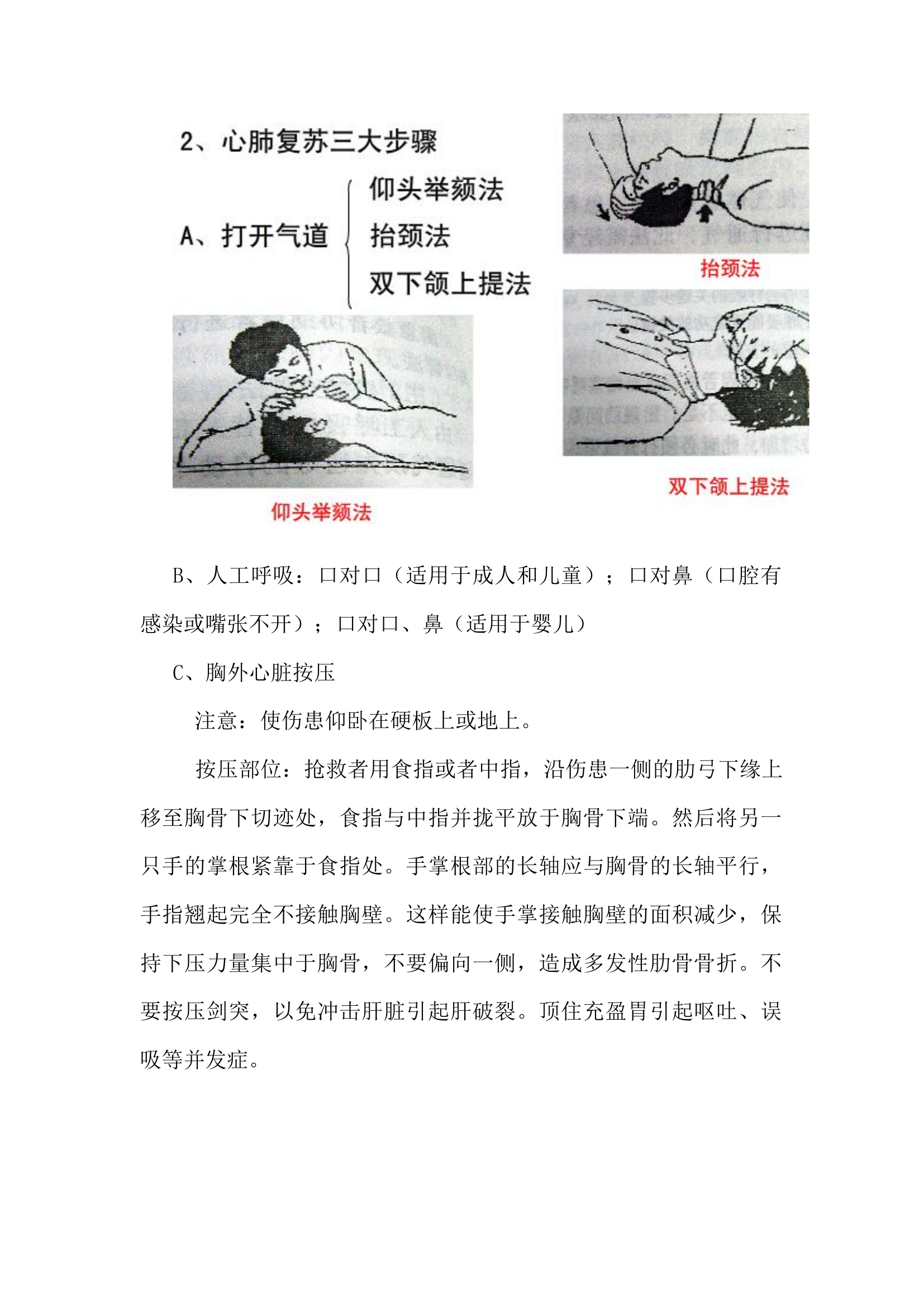 心肺复苏事件事故现场处置方案.docx 第2页