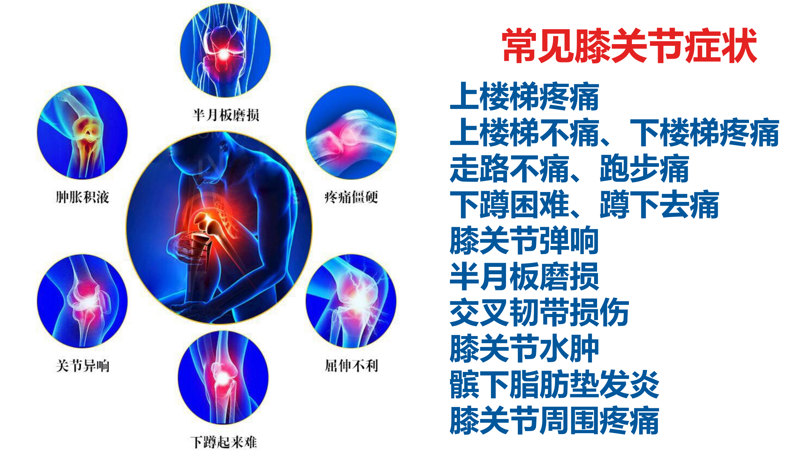 膝关节结构与常见症状的康复与调整 第2页