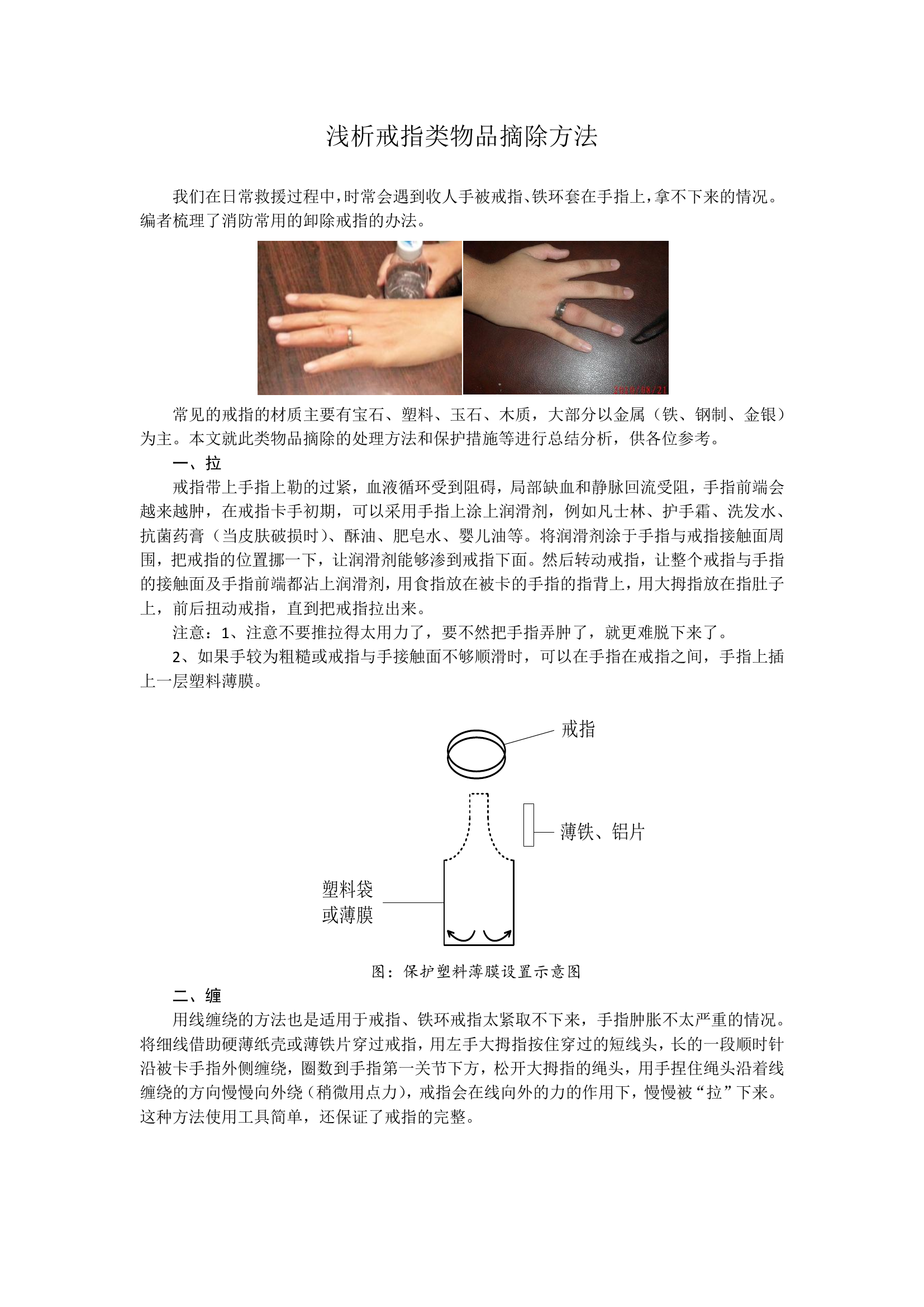 戒指类物品摘除方法.pdf 第1页