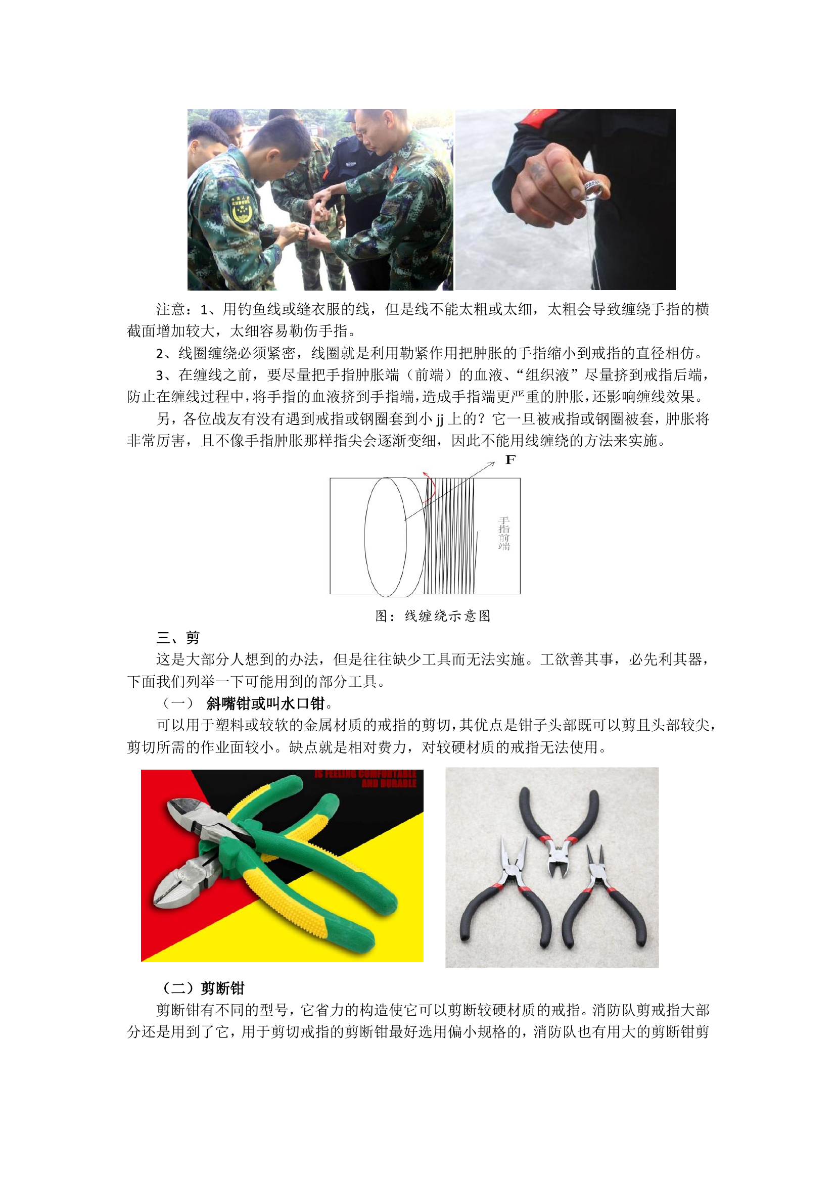 戒指类物品摘除方法.pdf 第2页
